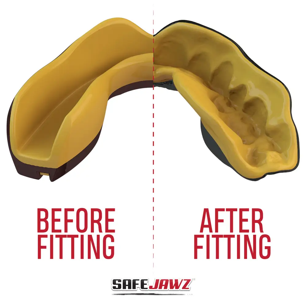 SafeJawz Extro Series Goldie Mouthguard 4 SafeJawz Extro Series Goldie Mouthguard - Image 4
